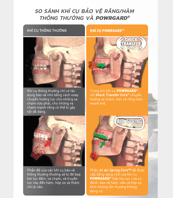 Bảng so sánh khí cụ bảo vệ răng/hàm thông thường và khí cụ POWRGARD®
