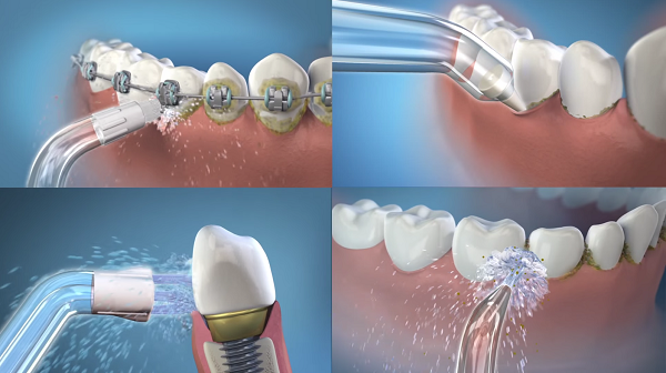 Những lợi ích mà máy tăm nước mang lại là gì?