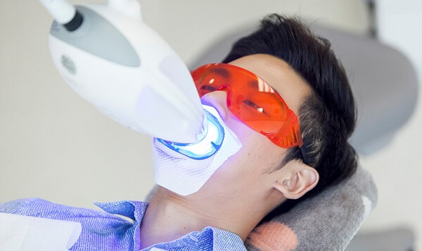 Phương pháp làm sạch mảng bám đen trên răng bằng công nghệ Laser Whitening