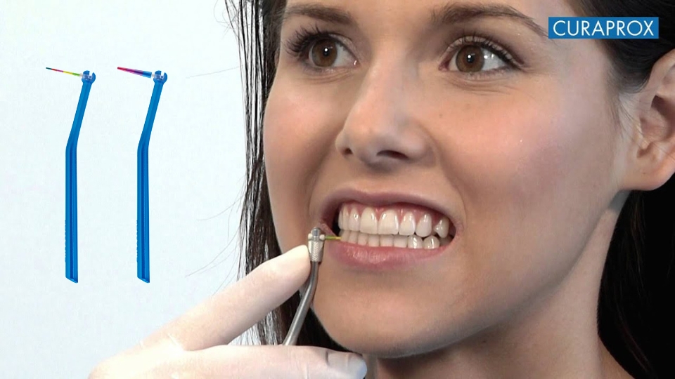 Hướng dẫn sử dụng Curaprox IAP để đo khoảng cách kẽ răng