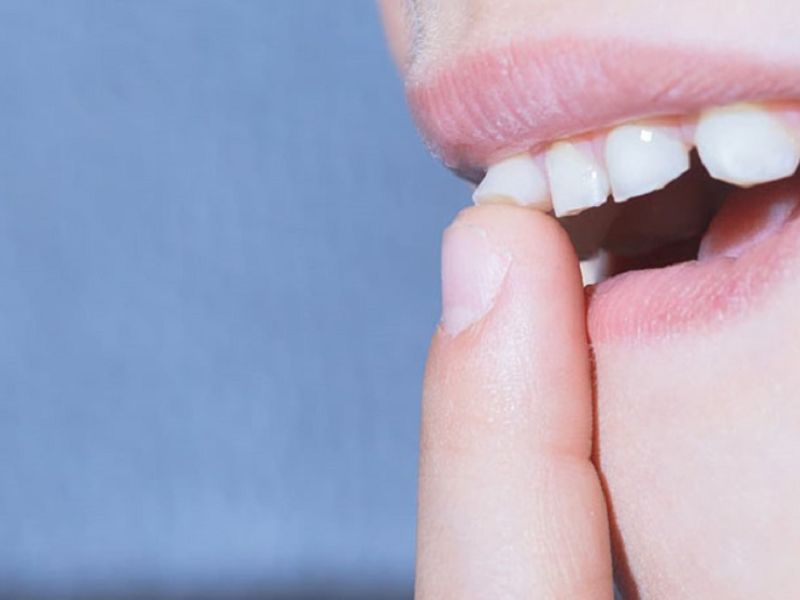 Những lý do khiến răng bị lung lay